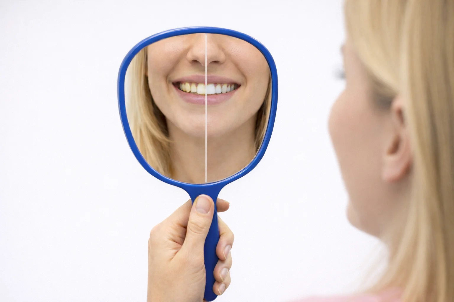 Trattamento di estetica dentale