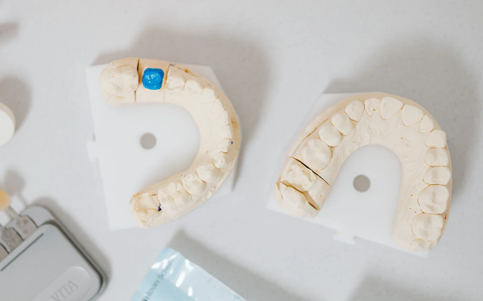 Modelli dentali utilizzati per la pianificazione del posizionamento della guida chirurgica
