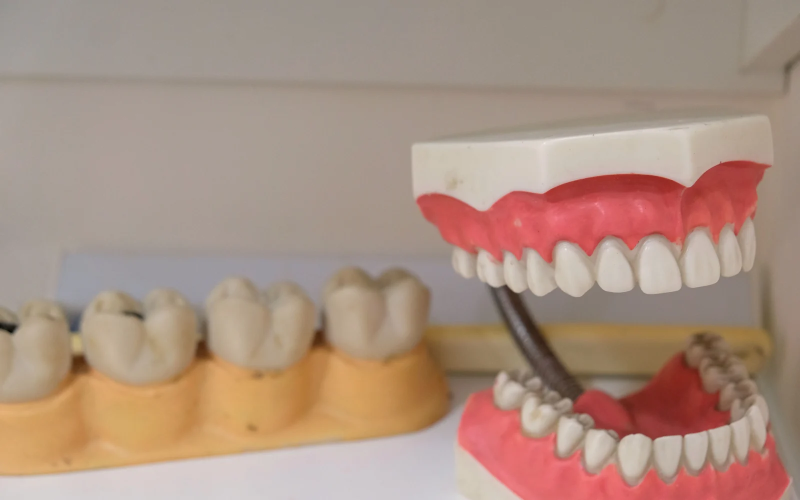 Modelli dentali e protesici per pianificazione implantare in pazienti edentuli